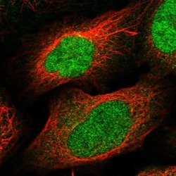 DBF4B Antibody, Novus Biologicals:Antibodies:Primary Antibodies